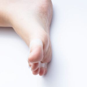 Hallus valgus – Zehenspreizer